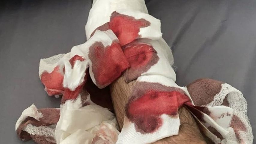 Juan Manuel Correas Bein nach seinem Unfall