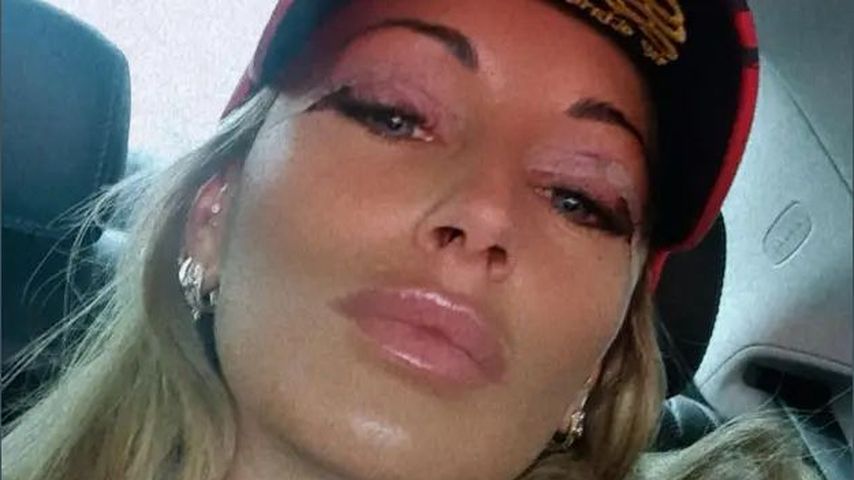 "Sehr glücklich": Julia Jasmin Rühle hatte Augenlidstraffung