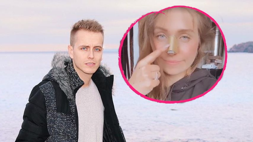 "So schön": Julian Claßen liebt Bibis neue Nase schon jetzt