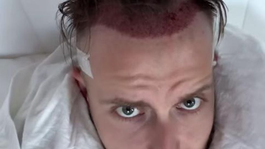 Julian Claßens neue Haare