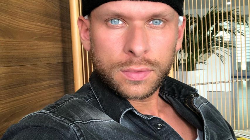 Julian kurz nach seiner Haartransplantation 2018
