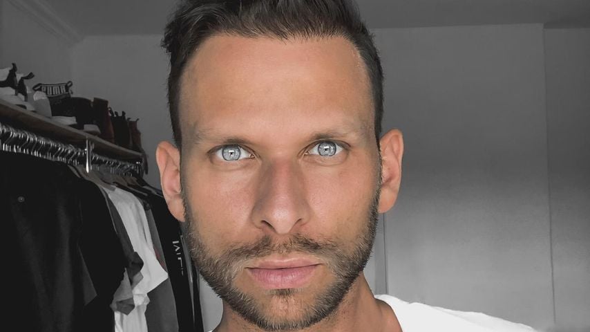 Trotz Transplantation: Ex-Bachelorette-Boy braucht Haarteil!