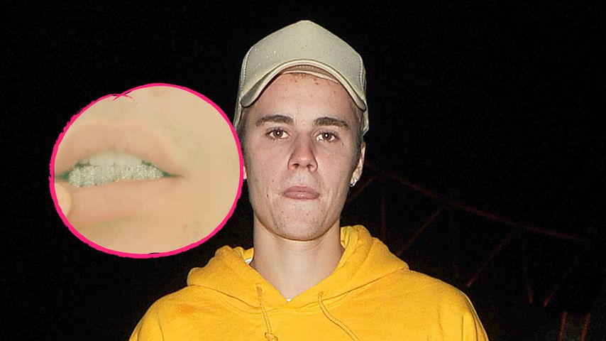 Für Hochzeit mit Hailey? Justin kauft Diamant-Zahnschmuck