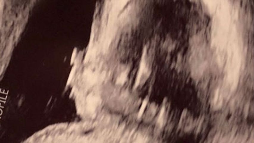 Ultraschallbild von Ashley Grahams Baby