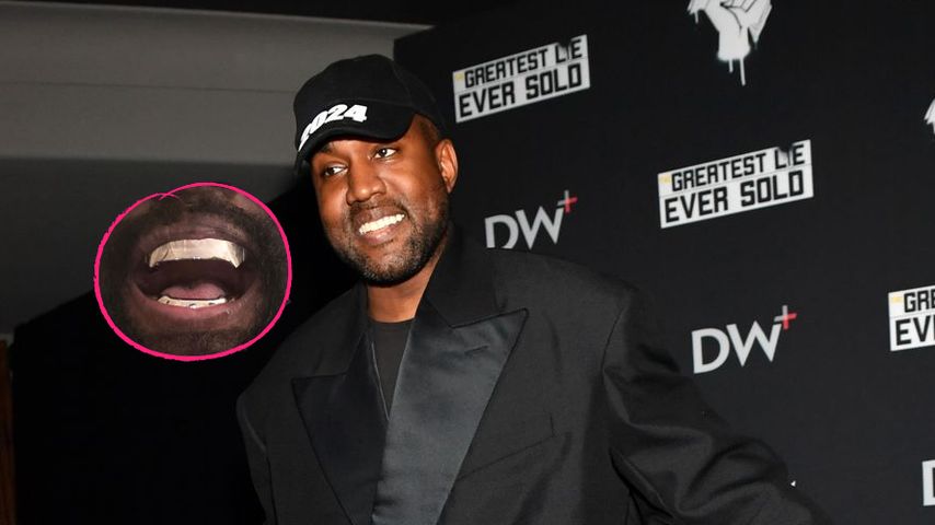 Skurril? Kanye West lässt Zähne entfernen für Titanprothese!