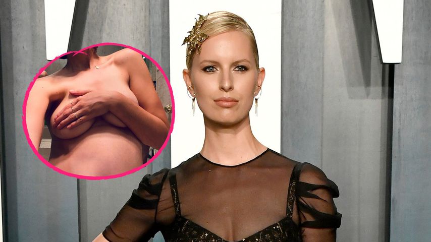 Komplett nackt: Karolina Kurkova ist jetzt in der 27. Woche