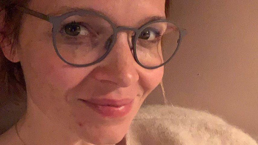 Lustiger Post: Karoline Herfurth wundert sich über Pickel