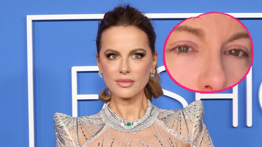 Mutter im Krankenhaus: Kate Beckinsale teilt Tränen-Selfie