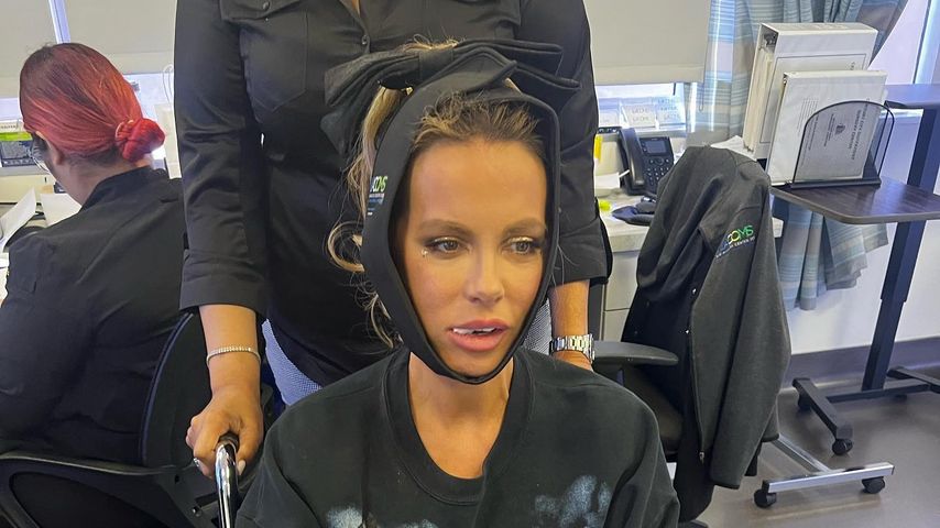 Kate Beckinsale teilt gnadenlos ehrliches Foto nach Zahn-OP