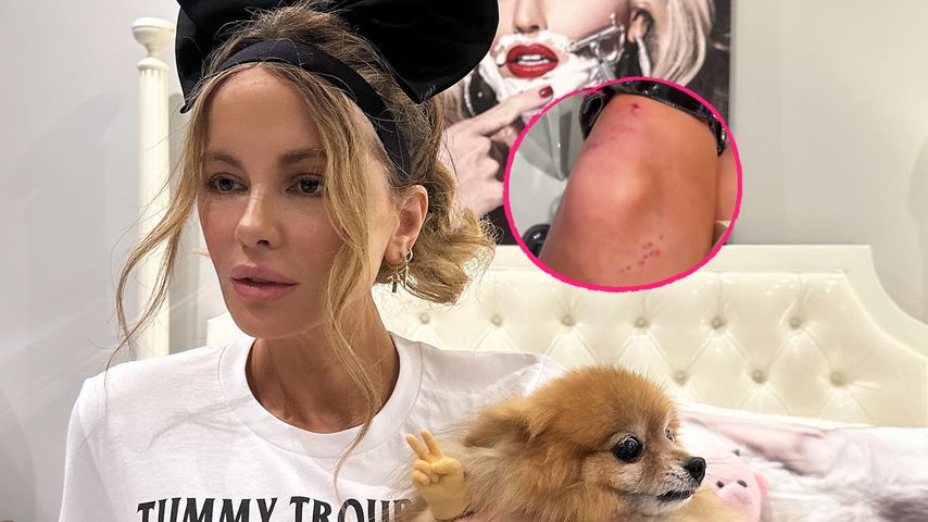 Kate Beckinsale verletzt sich während Suche nach ihrem Hund!