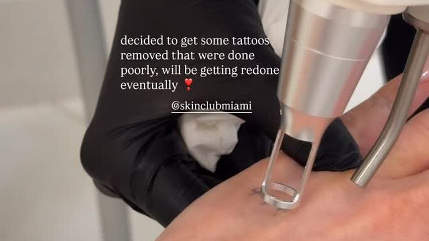 Kate Cassidy entfernt das "444"-Tattoo in Hommage an Liam Payne, Juli 2026