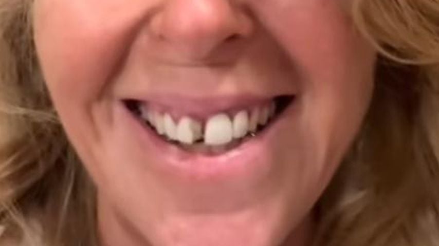 Kate Garraway zeigt auf Instagram ihren abgebrochenen Zahn, Januar 2026