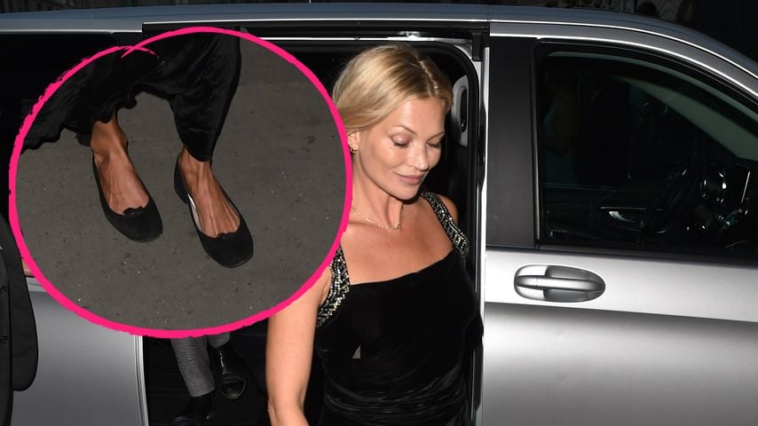 Beruhigend: Auch Stars wie Kate Moss und Co. haben Fuß-Makel