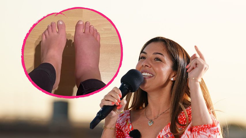 DSDS-Traum in Gefahr? Katharina bricht sich das Sprunggelenk