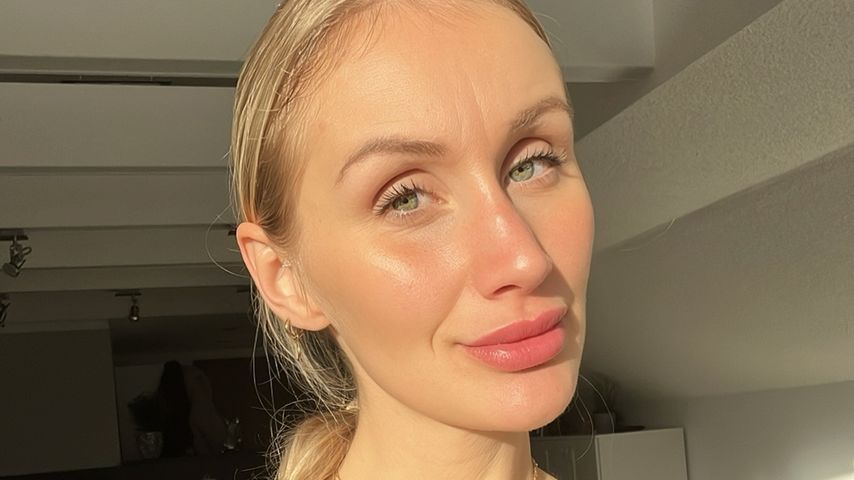 So sehr litt Influencerin Kathi Wagener unter Magersucht