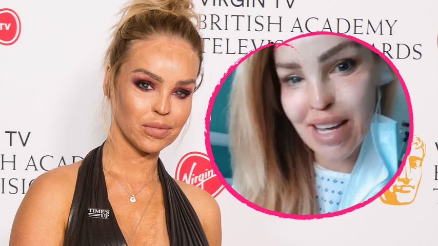 Über 200 OPs: Säure-Opfer Katie Piper wieder im Krankenhaus