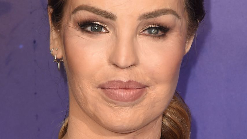 Katie Piper, TV-Star