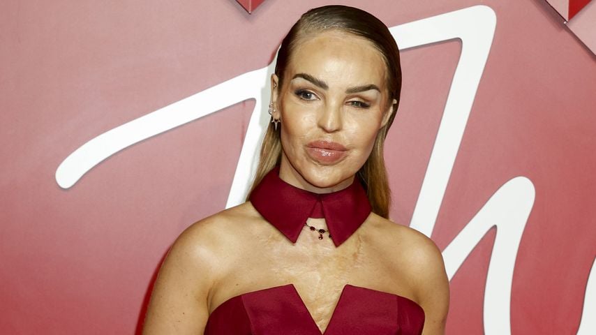 Katie Piper macht überraschendes Geständnis über ihre Ehe