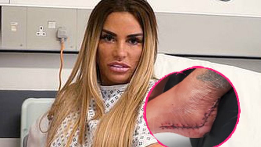 Schreit vor Schmerz: Katie Price' OP-Fäden werden gezogen