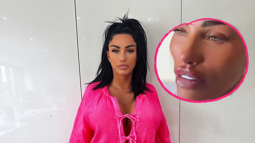 Nach Face-Lift: Katie Price lässt sich Lippen aufspritzen