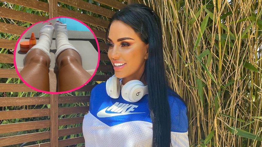 "Neue Bräunungsstreifen": Katie Price sonnt ihre Gipsbeine