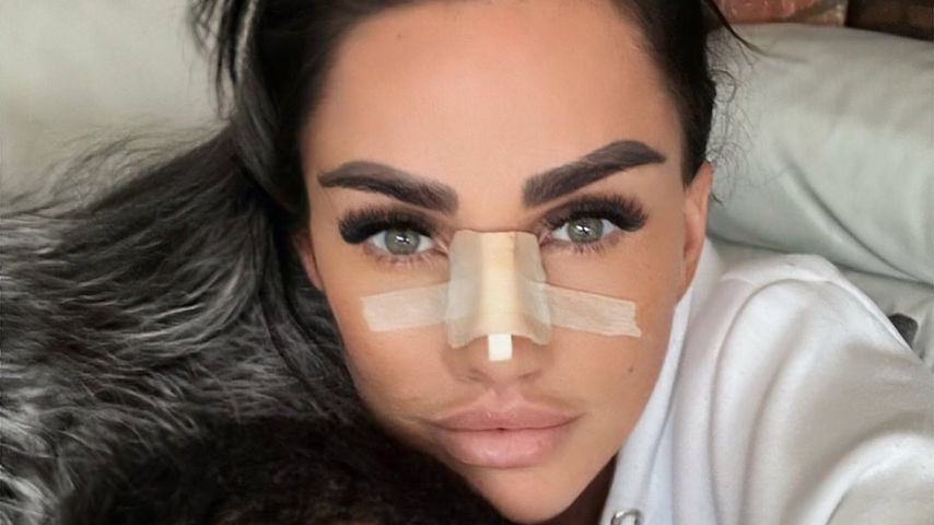 Katie Price nach einem Schönheitseingriff