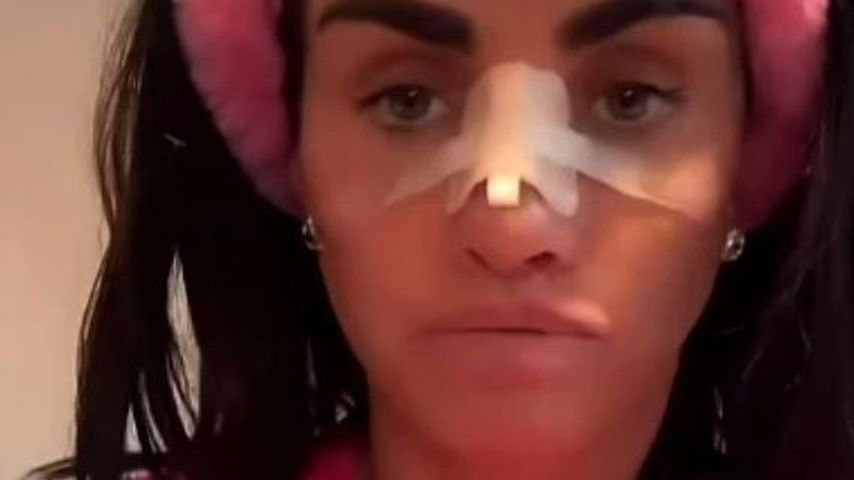 Katie Price im Juli 2023 nach ihrer Nasen-OP