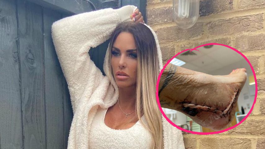 Zum Beweis: Katie Price teilt Fotos ihres genähten Fußes!