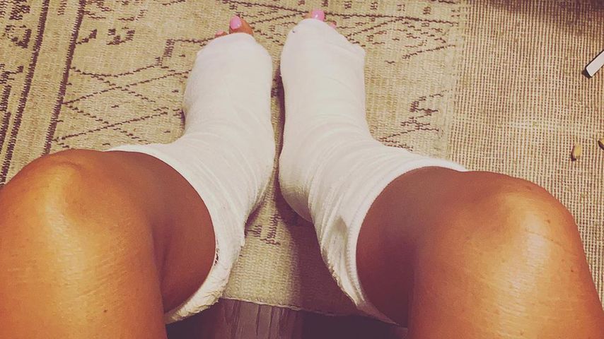 Katie Price zeigt ihre eingegipsten Beine