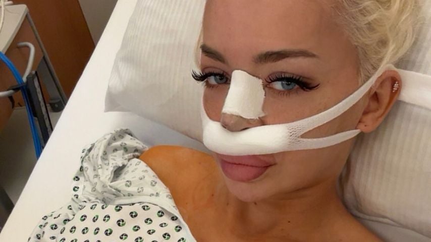 Katja Krasavice nach ihrer vierten Nasen-OP