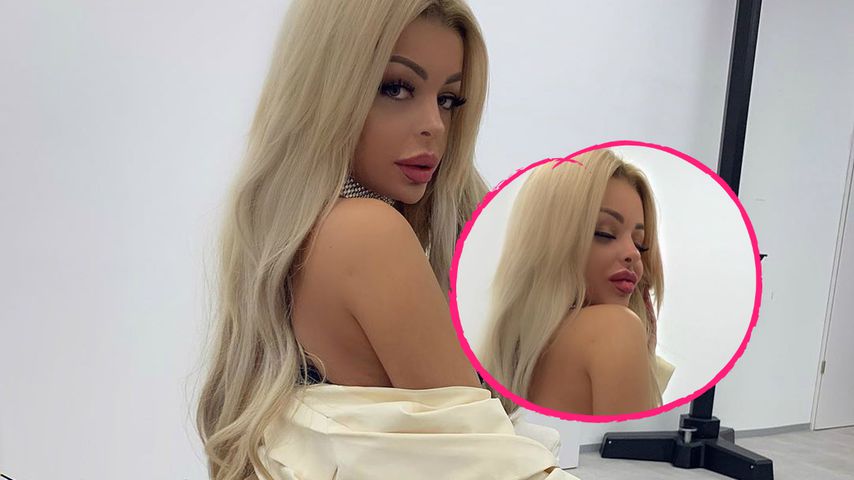 Nasen-OP? Katja Krasavice hat plötzlich eine Stupsnase!
