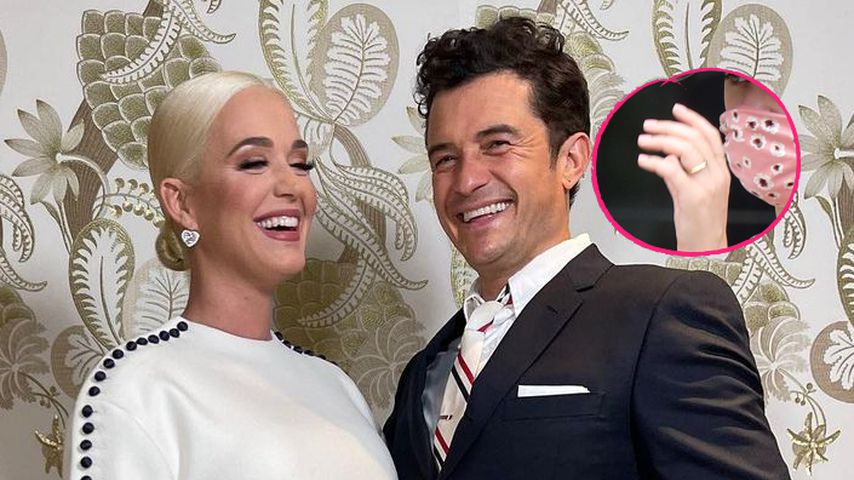 Verdächtiger Ring: Haben Katy Perry und Orlando geheiratet?