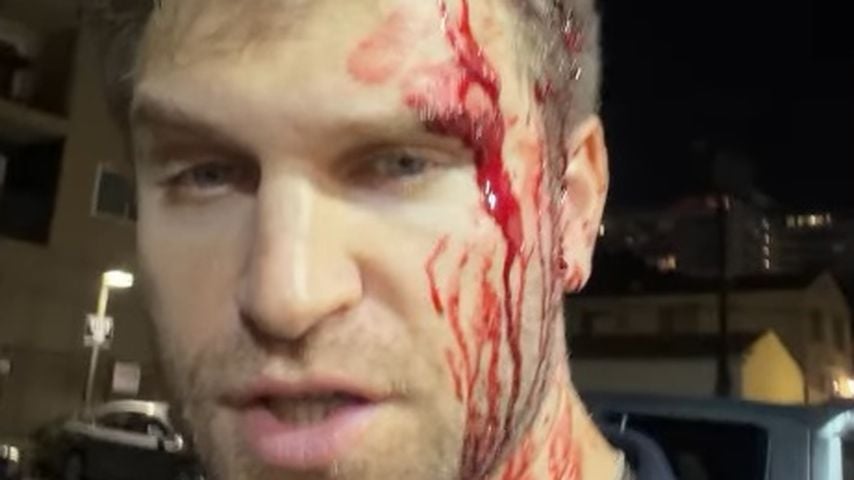 Keegan Allen zeigt sich blutüberströmt