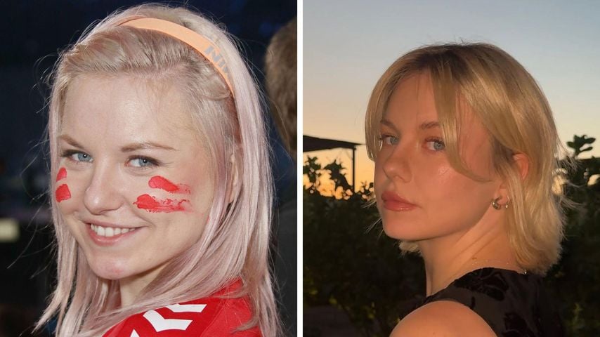 Kelly MissesVlog gesteht unzählige Schönheitseingriffe