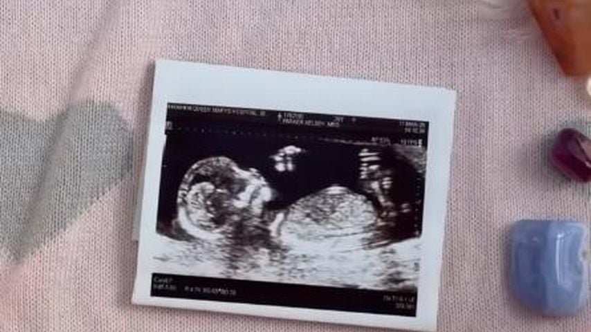 Kelsey Parkers Ultraschallbild, Mai 2026