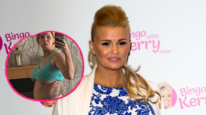 "Ich hasse mich": Kerry Katonas Körper ist stark geschwollen