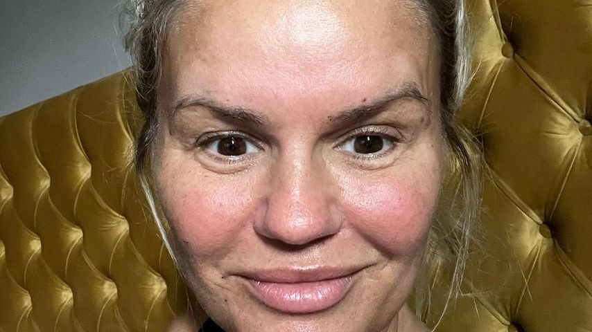 Extreme Schmerzen: Bereut Kerry Katona ihre Beauty-OP?