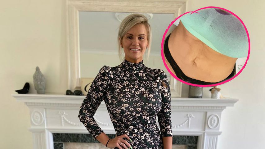 Atomic-Kitten-Star Kerry steht zu ihren Dehnungsstreifen
