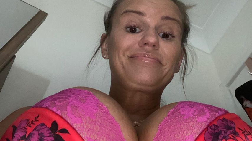 Rückenschmerzen: Kerry Katona lässt ihre Brüste verkleinern