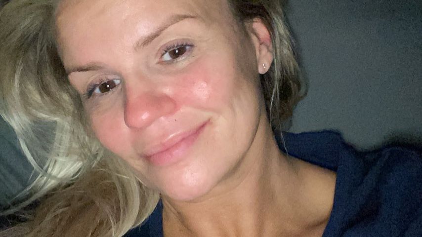 Kerry Katona im März 2020