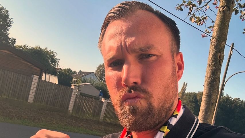 Kevin Großkreutz überrascht mit seiner Haartransplantation