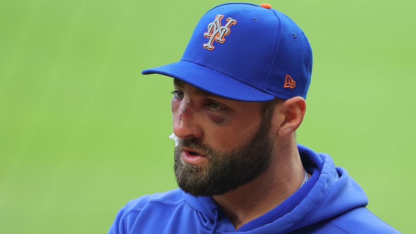 Blutige Bilder: Baseball-Star von Ball ins Gesicht getroffen