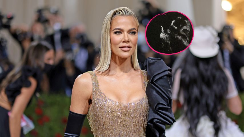Baby-Spucke: So unglamourös ist Khloé Kardashians Mama-Leben