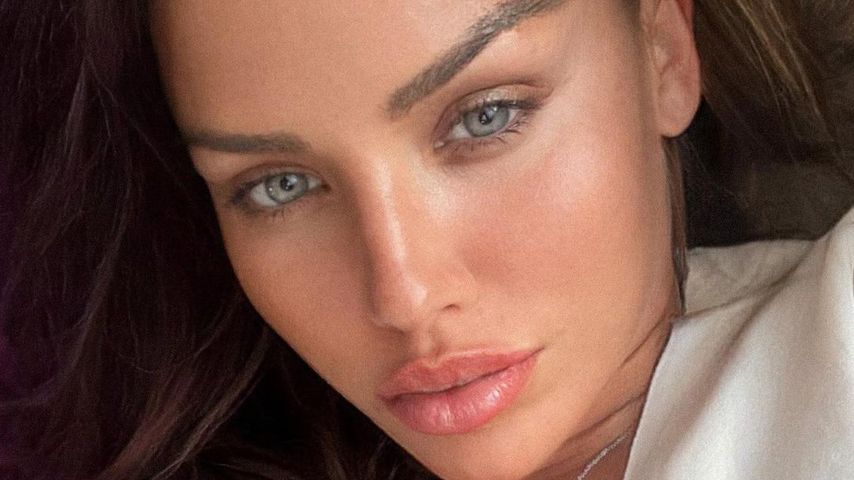 Kurz vor Hochzeit: Ärztin verbot Kim Gloss Beauty-Eingriff