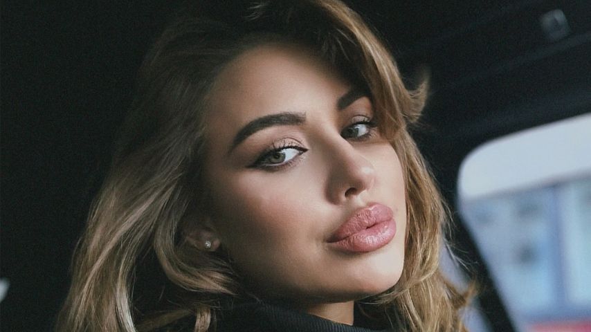 Kim Gloss verrät: Hatte sie nach der Geburt einen Babyblues?