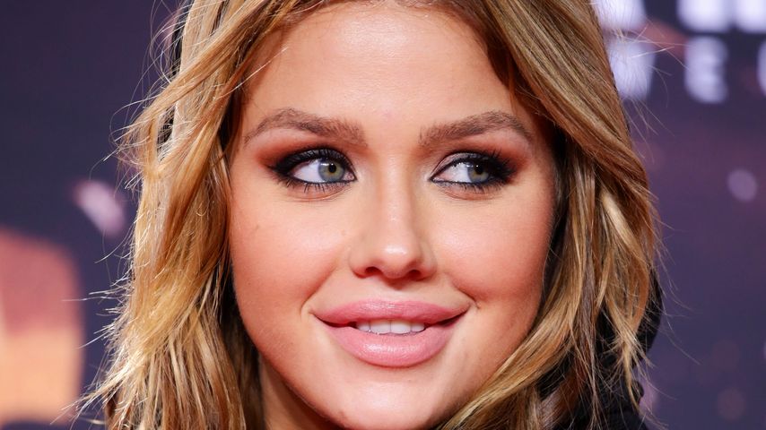Allergische Reaktion: Kim Gloss' Lippen total aufgequollen!