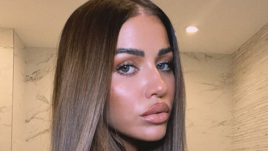 Kaum wiederzuerkennen: Kim Gloss verblüfft ihre Fans