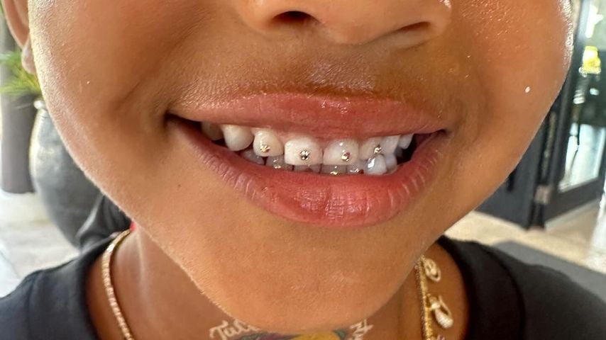 Kim Kardashians Tochter zeigt ihren Zahnschmuck