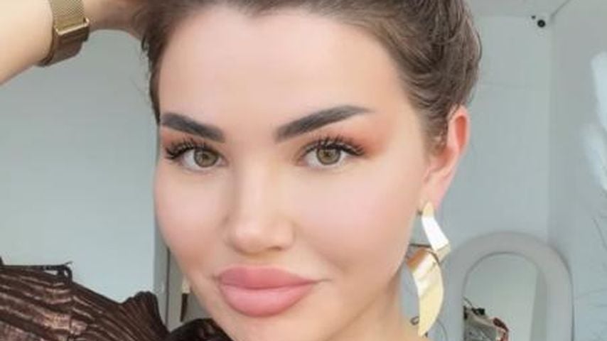 Wegen Hunden: Kim Virginia wird mit Konsequenzen gedroht