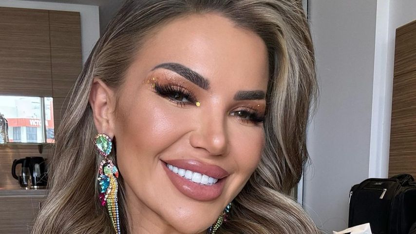 "Natürliche Maus": Kim Virginia lässt ihre Filler auflösen!